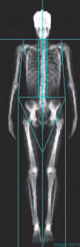 Body scan showing detailed composition analysis