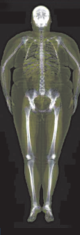 Body scan with bone density results